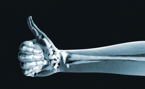 Ученые создали искусственный аналог костной ткани человека