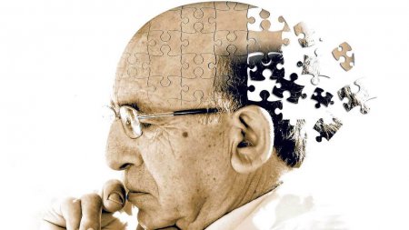 Учёные: Пациенты с болезнью Альцгеймера забывают лица родственников