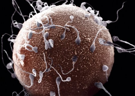 Учёные создали образцы спермы человека из клеток кожи