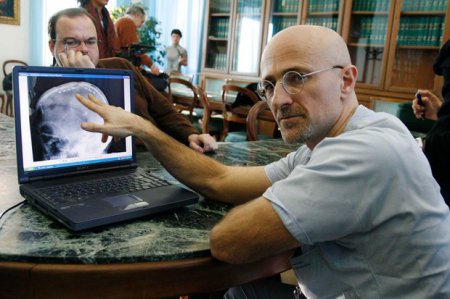 Серджио Канаверо: Российские ученые участвуют в подготовке к пересадке головы