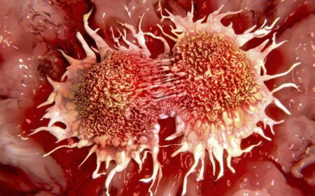 Ученые смогли проследить за «рождением» раковой клетки