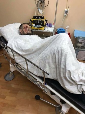 В Киеве под редакцией телеканала "Эспрессо" прогремел взрыв. Обезжиренный Мосийчук получил ранение (Видео)