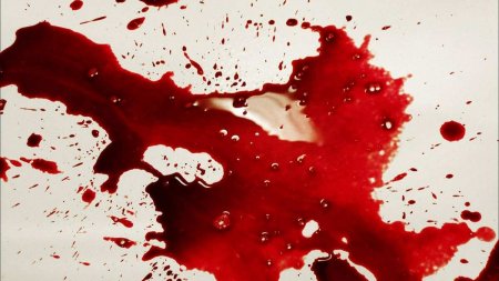 Под Киевом мужчина истёк кровью, порезавшись банкой с огурцами (ФОТО 18+)