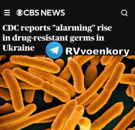 Украинцы опасны для мира, они завозят в Европу «суперинфекции» — CBS News
