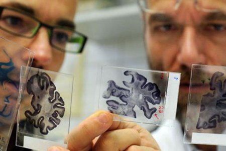 Ученые смогут вернуть стертые болезнью Альцгеймера воспоминания