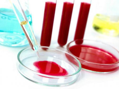 Ученые из Новосибирска разработали метод выявления рака по анализу крови