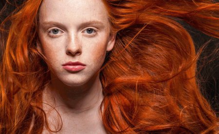 Ген рыжих волос значительно увеличивает риск возникновения раковых заболеваний кожи