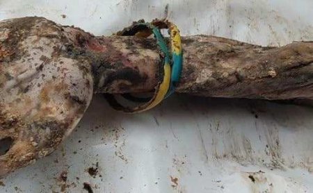 Бучи-2 не получится: вскрылась ложь о руке с браслетами из могилы в Изюме (ФОТО)
